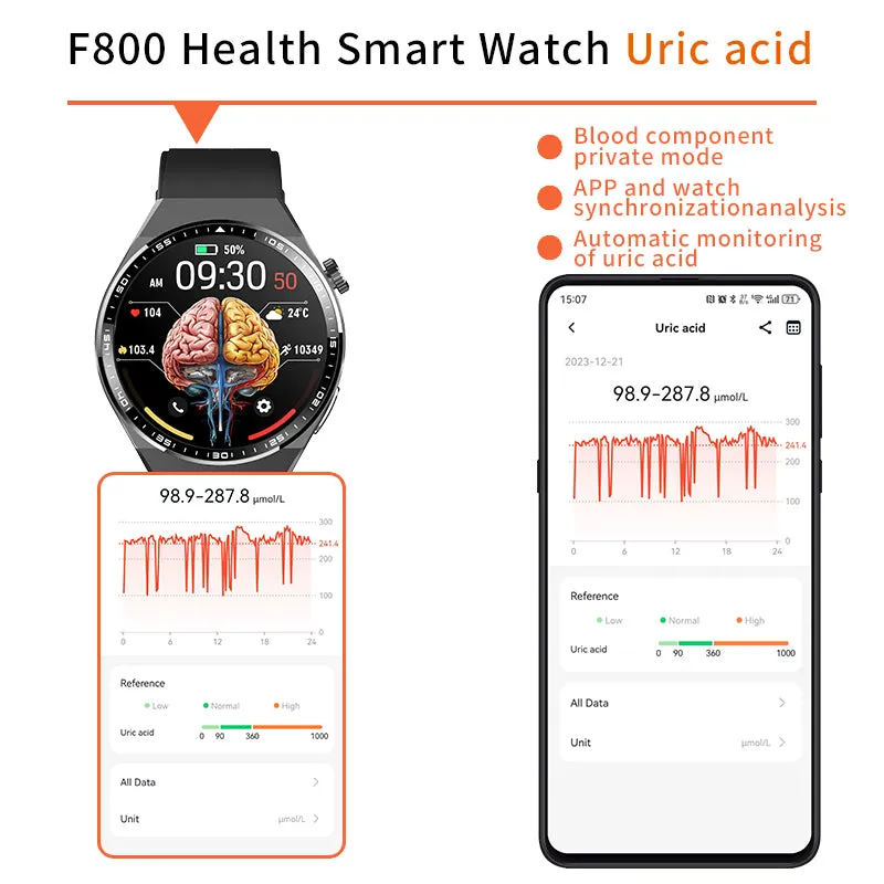 2024 New Accurate Measure ECG PPG Smart Watch Men Full Touch Screen Sport Fitness Watches Bluetooth For Android ios Smartwatch