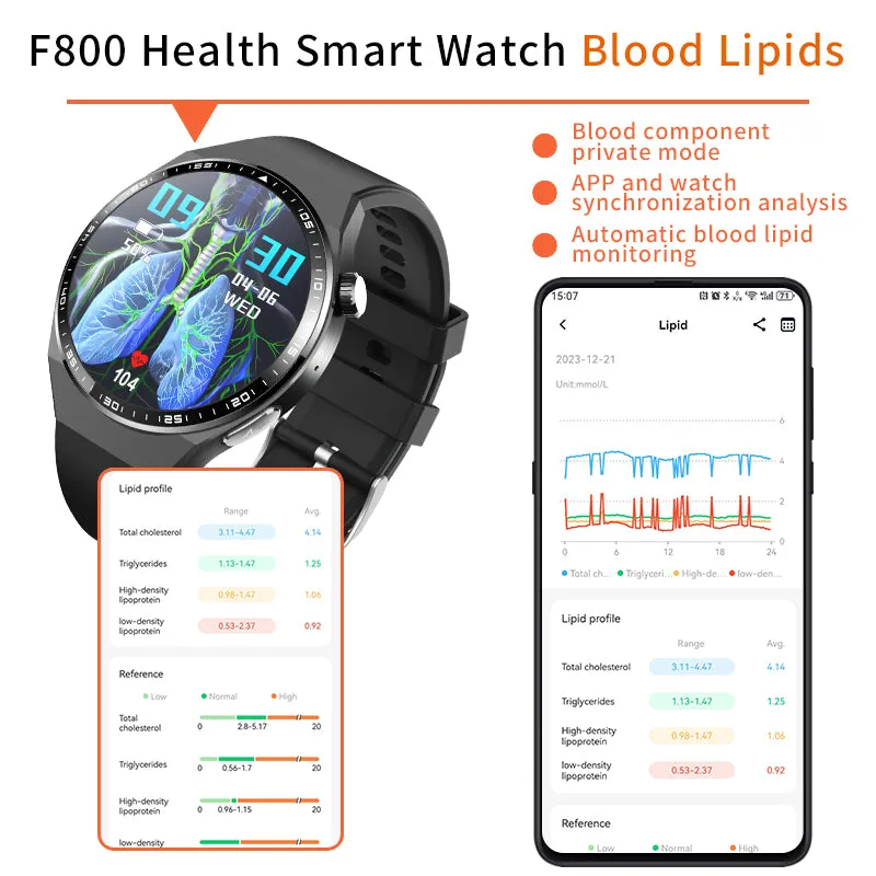 2024 New Accurate Measure ECG PPG Smart Watch Men Full Touch Screen Sport Fitness Watches Bluetooth For Android ios Smartwatch