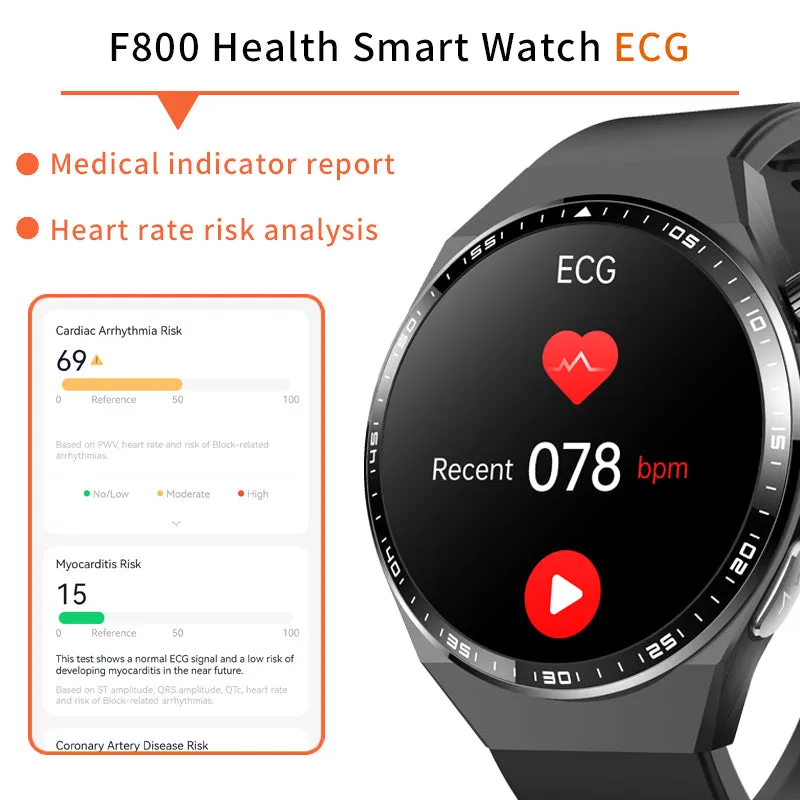 2024 New Accurate Measure ECG PPG Smart Watch Men Full Touch Screen Sport Fitness Watches Bluetooth For Android ios Smartwatch